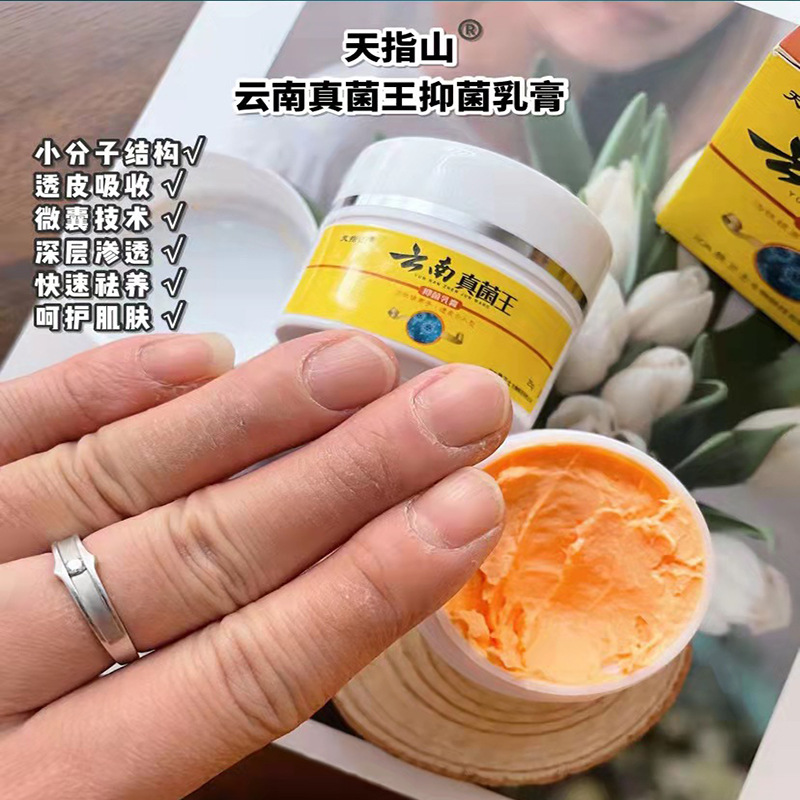 云南真菌王脚气偏方乳膏脚气水泡脱皮膏外用乳膏现货批发代发