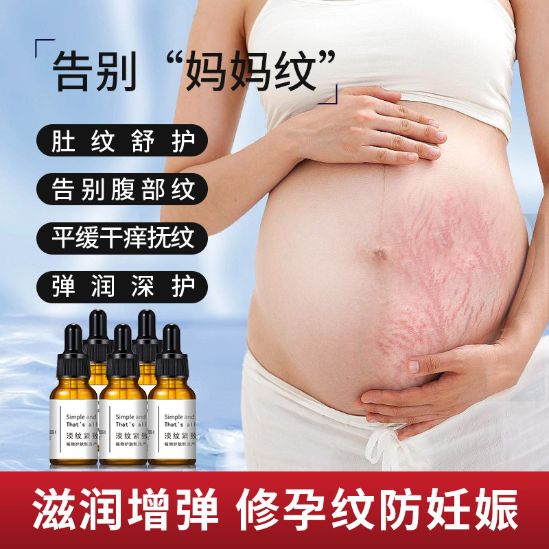 Light grain firming essence oil stretch marks growth marks pregnant women tattoo body lines light lines remove lines a generation of hair
