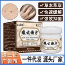 Wang Tailin wart superior folk prescription flat especially skin external use ointment filiform wart flat corns external use skin antibacterial ointment